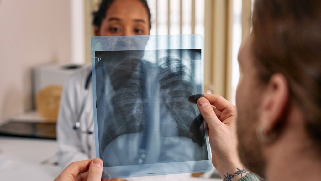 A doctor reviewing a chest X-ray with a patient.