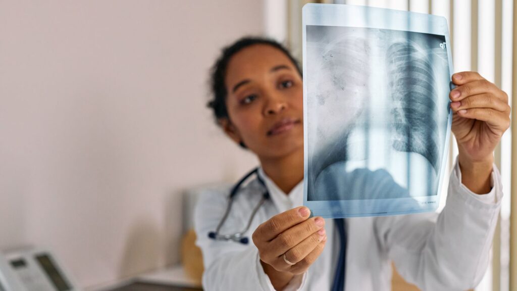 A clinician in a medical office holding up a chest X-ray film and studying the lungs on the image.
