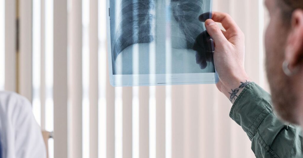 What Is the Treatment for Emphysema? Options and Where Pulmonary Rehab Fits