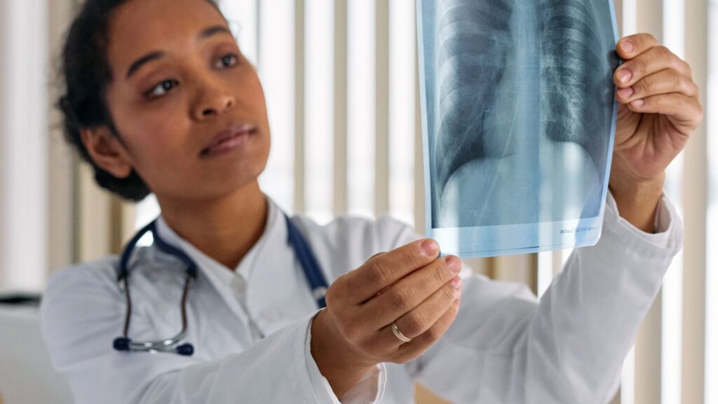 Doctor examining a chest X-ray
