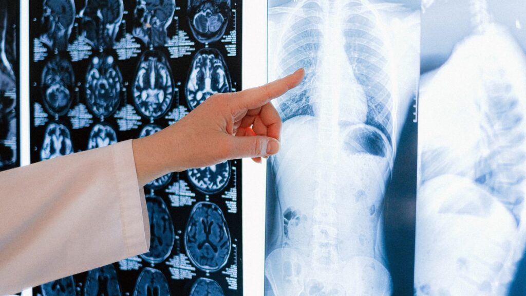 Is Online Pulmonary Rehab Covered by Insurance? Commercial Plans, Referrals and Prior Authorization